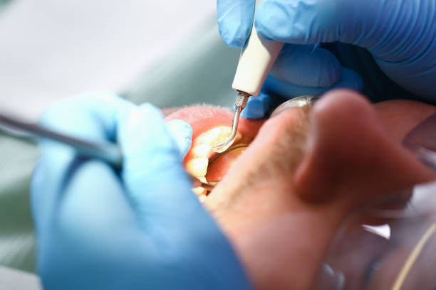 Best Root Canal Emergency Dentist  in Lake Park, IA